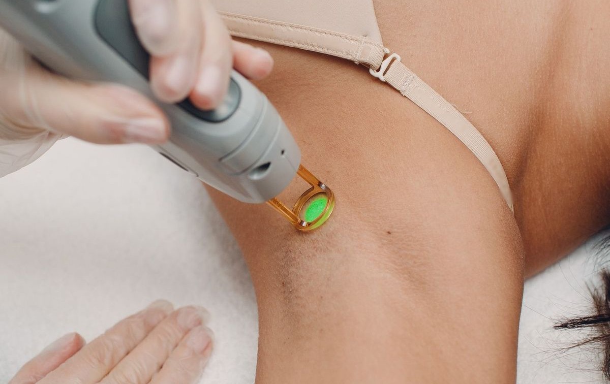Application du gel et passage du laser